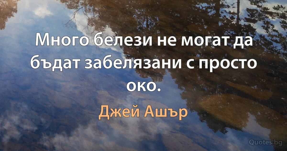 Много белези не могат да бъдат забелязани с просто око. (Джей Ашър)